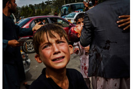 fot. Marcus Yam / LA Times, Chłopiec płacze, gdy mężczyzna niesie zakrwawione dziecko drogą prowadzącą na lotnisko w Kabulu. 17 września 2021 roku / Pulitzer Prize 2021 for Breaking News Photography