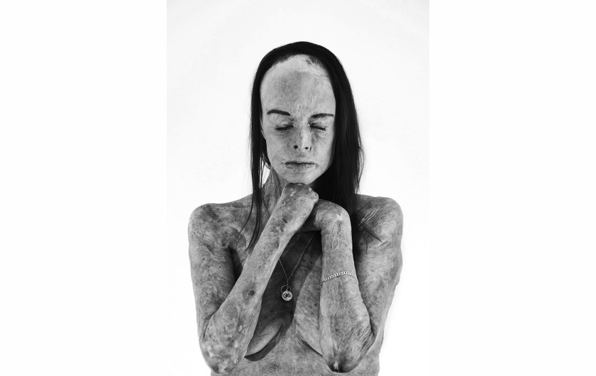 fot. Brian Cassey, The Skin I'm In - II, 2. miejsce w kategorii Portrait