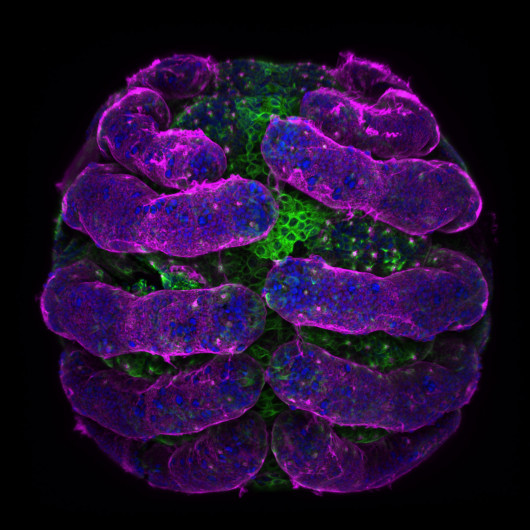 fot. Tessa Montague, embrion pająka, 5. miejsce w konkursie Nikon Small World 2018