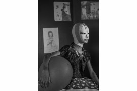 © Alessio Mamo (Redux Pictures), "Manal, War Portraits" - II miejsce  w kategorii  PEOPLE SINGLES / Manal (11 lat), ofiara wybuchu pocisku w Kirkuku w Iraku, nosi maskę przez kilka godzin dziennie, aby chronić twarz po skomplikowanej operacji plastycznej w Szpitalu Al-Mowasah w Ammanie w Jordanii.