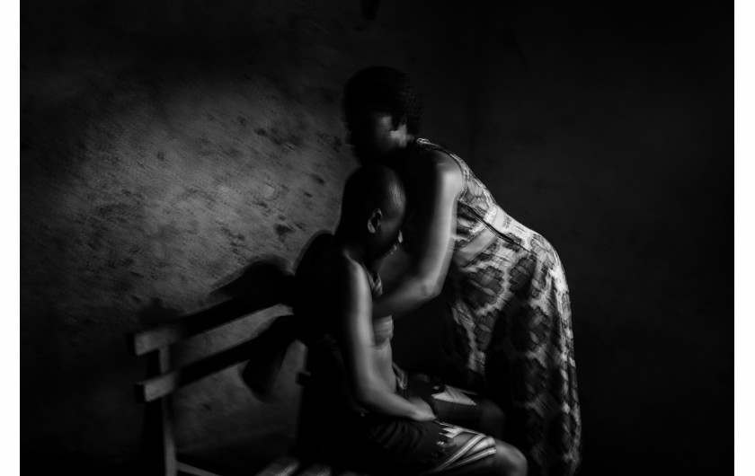 © Heba Khamis, Banned Beauty - I miejsce w kategorii CONTEMPORARY ISSUES STORIES / Praktyka „maskowania piersi“ u dziewcząt w wieku od ośmiu do dwunastu lat w Kamerunie odbywa się w przekonaniu, że opóźni to dojrzałość i pomoże zapobiec gwałtom lub wykorzystywaniu na tle seksualnym.