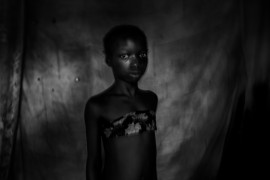 © Heba Khamis, "Banned Beauty" - I miejsce w kategorii CONTEMPORARY ISSUES STORIES / Praktyka „maskowania piersi“ u dziewcząt w wieku od ośmiu do dwunastu lat w Kamerunie odbywa się w przekonaniu, że opóźni to dojrzałość i pomoże zapobiec gwałtom lub wykorzystywaniu na tle seksualnym.