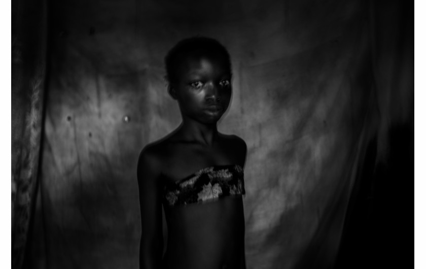 © Heba Khamis, Banned Beauty - I miejsce w kategorii CONTEMPORARY ISSUES STORIES / Praktyka „maskowania piersi“ u dziewcząt w wieku od ośmiu do dwunastu lat w Kamerunie odbywa się w przekonaniu, że opóźni to dojrzałość i pomoże zapobiec gwałtom lub wykorzystywaniu na tle seksualnym.