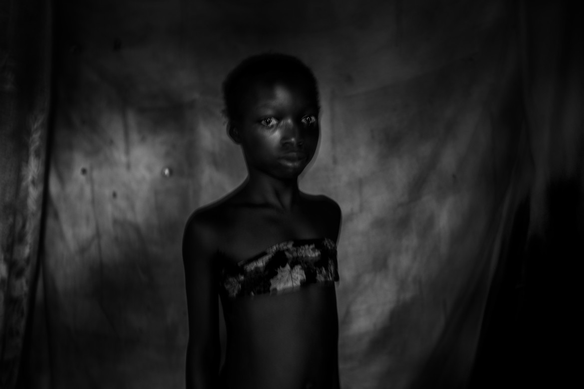 © Heba Khamis, "Banned Beauty" - I miejsce w kategorii CONTEMPORARY ISSUES STORIES / Praktyka „maskowania piersi“ u dziewcząt w wieku od ośmiu do dwunastu lat w Kamerunie odbywa się w przekonaniu, że opóźni to dojrzałość i pomoże zapobiec gwałtom lub wykorzystywaniu na tle seksualnym.