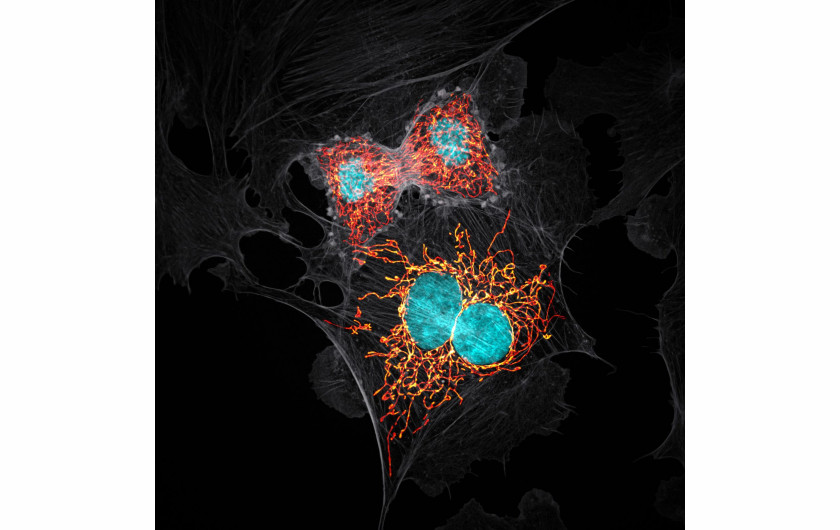 fot. Jason M. Kirk, komórki BPAE w telofazie, 10. miejsce w konkursie Nikon Small World 2019