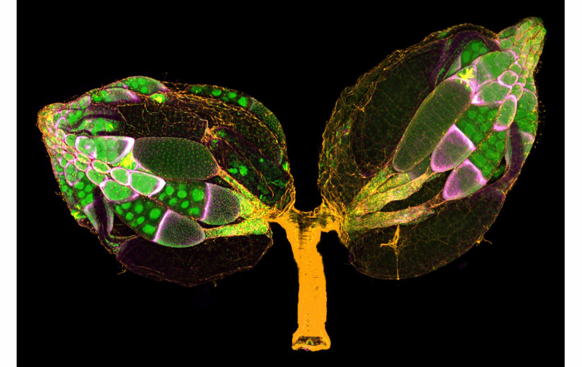 fot. Yujun Chen, Jocelyn McDonald, jajniki muszki owocowej, 11. miejsce w konkursie Nikon Small World 2019