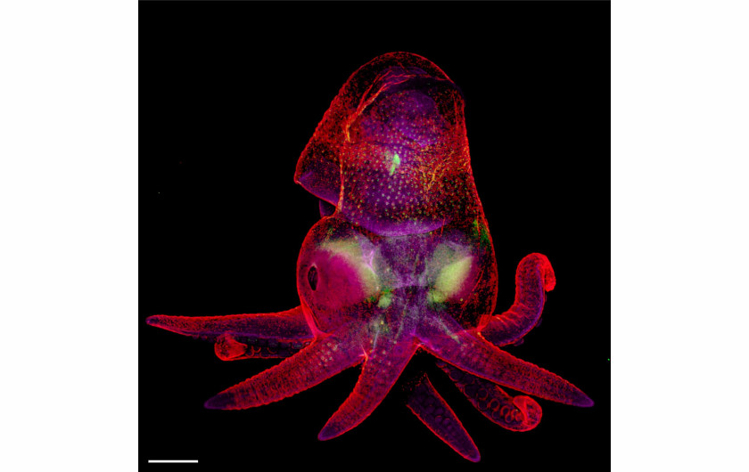 fot. Martyna Lukoseviciute, Carrie Albertin, embrion Octopus bimaculoides, 19. miejsce w konkursie Nikon Small World 2019