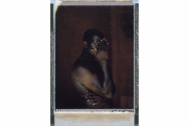 1. miejsce w kategorii Portrait Series, fot. Robin Hammond, z cyklu  "Where Love is Illegal"