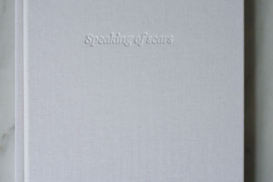 Teresa Eng "Speaking of scars" - recenzja