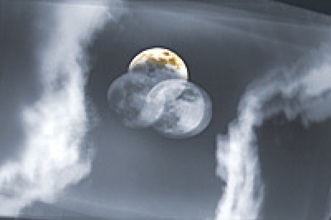 Miesiąc Fotografii w Bratysławie 2004