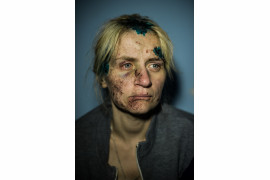 fot. Alexey Furman - "Shelling Survivor" nagrodzone pojedyncze zdjęcie 
