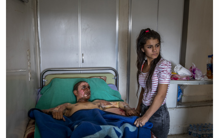 fot. Ivor Prickett20 października 2019. Szpital w Al-Hasakah, Syria. Ahmed Ibrahim został silnie poparzony w trakcie nalotu myśliwców SDF. Mimo przerażenia, młoda dziewczyna odwiedza chłopaka by potrzymać go na duchu.