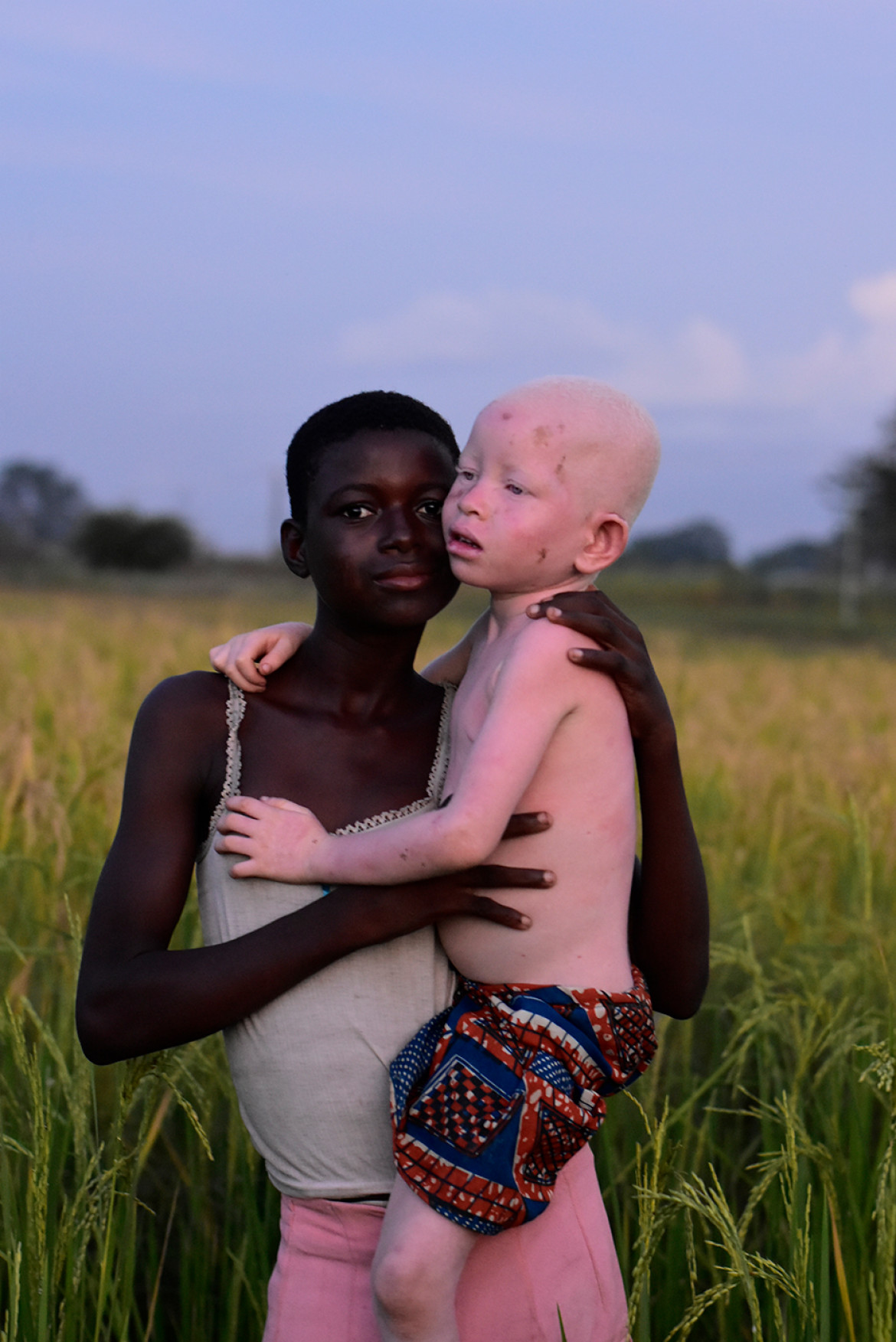 fot. Sara De Antonio Feu, "Ayimpoka", 1. miejsce w kategorii pojedynczej Next Genration Award.<br>/<br><br>/<br>Ayimpoka mieszka ze swoją rodziną w niewielkim mieście Bolgatanga w Ghanie. Albinizm w Afryce od lat jest powodem dyskryminacji i prześladowań. Dzięci dotknięte tą przypadłością są często mordowane ze względu na przypisywany im związek z magią i czarami. Dziewczynka jest pod stałą ochroną swojej rodziny oraz organizacji NGO. W dniu, w którym zrobiono zdjęcie Ayimpoka walczyła z malarią i poparzeniami słonecznymi.