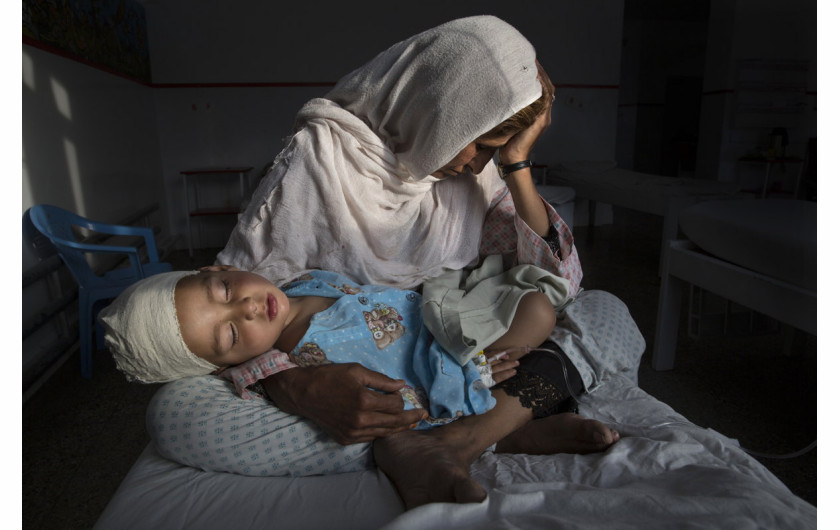 fot. Paula Bronstein, The Silent Victims Of A Forgotten War, 1. miejsce w kategorii Daily Life / Singles.

Kobieta trzyma w objęciach swojego dwuletniego siostrzeńca, który został ranny podczas wybuchy bomby w Kabulu, 29 marca 2016 roku.