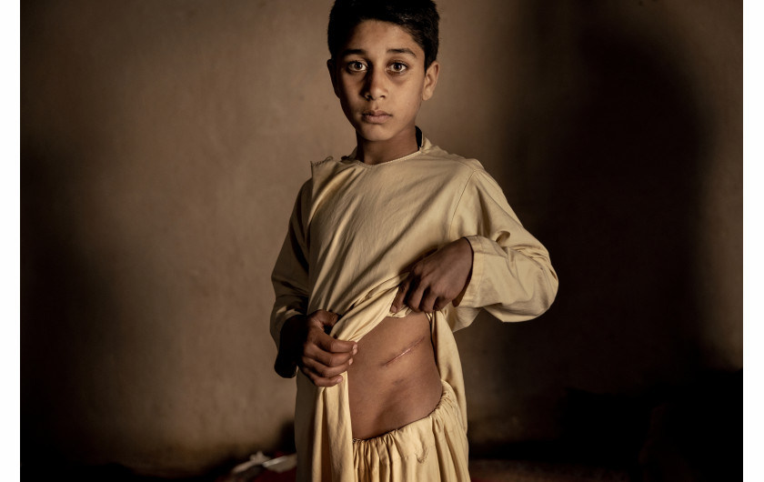 fot. Mads Nissen Politiken, Panos Pictures, nominacja z regionu Azji / World Press Photo 2023Po wycofaniu sił amerykańskich i sojuszniczych z Afganistanu w sierpniu 2021 roku, do władzy powrócili talibowie. W odpowiedzi inne państwa wstrzymały pomoc zagraniczną i zamroziły miliardy dolarów rezerw rządowych zdeponowanych za granicą. Intensywne susze w 2022 roku pogłębiły kryzys gospodarczy; obecnie połowa mieszkańców kraju nie ma co jeść, a ponad milion dzieci, według ONZ, jest poważnie niedożywionych. Ta historia oddaje wiele trudności, z jakimi Afgańczycy borykają się w codziennym życiu.