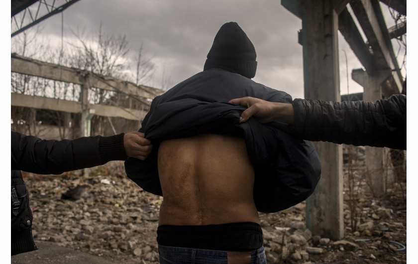 fot. Alessio Paduano, Migrant z Afganistanu pokazuje blizny po ranach, które według jego zeznań, zadali mu chorwaccy policjanci, gdy kilka miesięcy temu próbował przekroczyć granicę w Bihacu w Bośni i Hercegowinie, 22 stycznia, 2021 r.