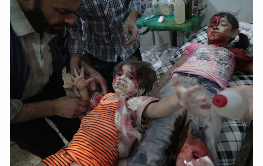 fot. Abd Doumany, Medics Assist a Wounded Girl, 2. miejsce w kategorii Spot News / Singles.

Syryjska dziewczynka płacze w sąsiedztwie chłopca rannego w atakach lotniczych na miasto Douma, 12 sierpnia 2016 roku.