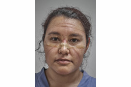 fot. Iván Macías, Meksyk, "COVID-19 First Responder", nominacja w kategorii "Portret - zdjęcie pojedyncze"<br></br><br></br>Lekarz pod koniec swojej zmiany w czasie pandemi. ślady pozostawione przez maskę ochronną i gogle są wyraźnie widoczne na jej twarzy, Meksyk, 19 maja 2021 r.<br></br><br></br>Pracownicy służby zdrowia na całym świecie stanęli na czele walki z nowym koronawirusem, COVID-19, który powstał w Chinach i szybko rozprzestrzenił się na cały świat. Spośród 37 krajów przebadanych przez Forbes w listopadzie 2020 roku, Meksyk zgłosił 78200 zakażeń COVID wśród pracowników służby zdrowia. Po uwzględnieniu wielkości populacji był to najwyższy wskaźnik na świecie.<br></br><br></br>Pierwsze przypadki COVID-19 w Meksyku potwierdzono pod koniec lutego. W marcu prezydent López Obrador zmniejszył stopień zagrożenia ze strony wirusa, umożliwiając kontynuowanie dużych zgromadzeń publicznych i przygotowań do sezonu turystycznego. Gdy liczba przypadków zaczęła rosnąć, pod koniec marca weszła w życie blokada, ale w kwietniu prezydent ogłosił, że wirus jest pod kontrolą.<br></br><br></br>13 maja, mniej niż 24 godziny po tym, jak kraj ogłosił swój najbardziej śmiertelny dzień podczas pandemii (353 zgony), Obrador zalecił złagodzenie środków blokujących. Meksyk znalazł się również pod presją Stanów Zjednoczonych, aby ponownie otworzyć swoją gospodarkę w celu zapewnienia kontynentalnych łańcuchów dostaw. Wyczerpani pracownicy służby zdrowia stawali się coraz bardziej krytyczni wobec polityków, którzy nie wymuszali surowszych przepisów przeciw COVID.