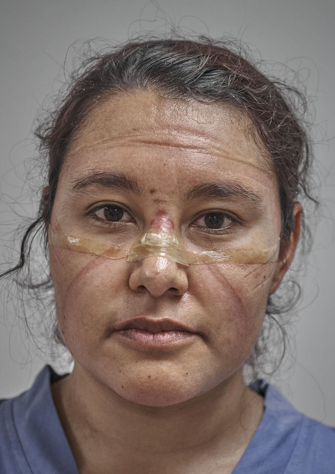 fot. Iván Macías, Meksyk, "COVID-19 First Responder", nominacja w kategorii "Portret - zdjęcie pojedyncze"<br></br><br></br>Lekarz pod koniec swojej zmiany w czasie pandemi. ślady pozostawione przez maskę ochronną i gogle są wyraźnie widoczne na jej twarzy, Meksyk, 19 maja 2021 r.<br></br><br></br>Pracownicy służby zdrowia na całym świecie stanęli na czele walki z nowym koronawirusem, COVID-19, który powstał w Chinach i szybko rozprzestrzenił się na cały świat. Spośród 37 krajów przebadanych przez Forbes w listopadzie 2020 roku, Meksyk zgłosił 78200 zakażeń COVID wśród pracowników służby zdrowia. Po uwzględnieniu wielkości populacji był to najwyższy wskaźnik na świecie.<br></br><br></br>Pierwsze przypadki COVID-19 w Meksyku potwierdzono pod koniec lutego. W marcu prezydent López Obrador zmniejszył stopień zagrożenia ze strony wirusa, umożliwiając kontynuowanie dużych zgromadzeń publicznych i przygotowań do sezonu turystycznego. Gdy liczba przypadków zaczęła rosnąć, pod koniec marca weszła w życie blokada, ale w kwietniu prezydent ogłosił, że wirus jest pod kontrolą.<br></br><br></br>13 maja, mniej niż 24 godziny po tym, jak kraj ogłosił swój najbardziej śmiertelny dzień podczas pandemii (353 zgony), Obrador zalecił złagodzenie środków blokujących. Meksyk znalazł się również pod presją Stanów Zjednoczonych, aby ponownie otworzyć swoją gospodarkę w celu zapewnienia kontynentalnych łańcuchów dostaw. Wyczerpani pracownicy służby zdrowia stawali się coraz bardziej krytyczni wobec polityków, którzy nie wymuszali surowszych przepisów przeciw COVID.
