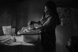 fot. Lalo de Almeida, "Victims of The Zika Virus", 2. miejsce w kategorii Contemporary Issues / Stories.

W sierpniu 2015 roku w Brazylii zaczęły rodzić się dzieci z małogłowiem i innymi deformacjami. W kwietniu 2016 roku rozpoznano przyczynę w postaci wirusa Zika. Północno-wschodni region Brazylii, gdzie miejsce miała największa liczba urzodzin dzieci z małogłowiem, jest jednym z najbiedniejszych regionów kraju, z bardzo słabo rozwiniętą opieką medyczną. Wiele rodzin musi przemierzać z dziećmi setki kilometrów, by otrzymać pomoc.