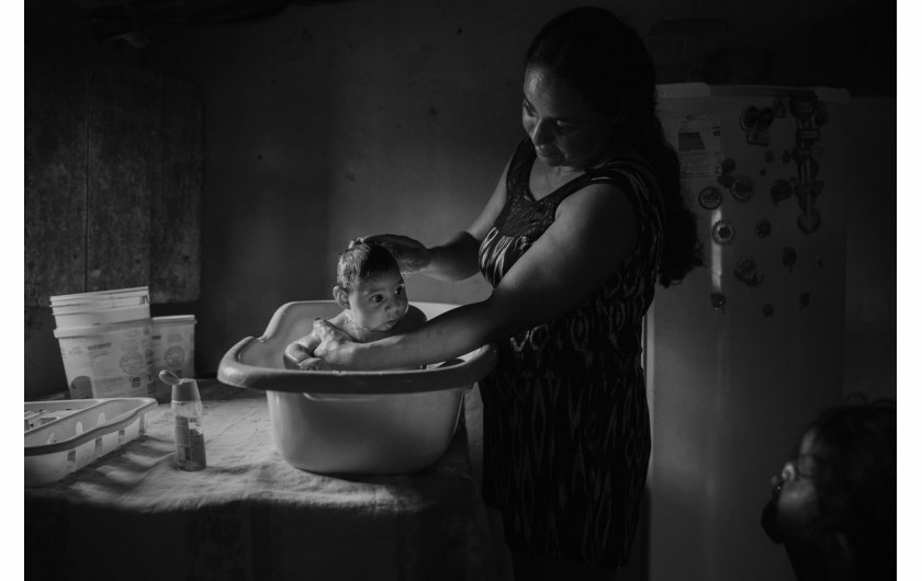 fot. Lalo de Almeida, Victims of The Zika Virus, 2. miejsce w kategorii Contemporary Issues / Stories.

W sierpniu 2015 roku w Brazylii zaczęły rodzić się dzieci z małogłowiem i innymi deformacjami. W kwietniu 2016 roku rozpoznano przyczynę w postaci wirusa Zika. Północno-wschodni region Brazylii, gdzie miejsce miała największa liczba urzodzin dzieci z małogłowiem, jest jednym z najbiedniejszych regionów kraju, z bardzo słabo rozwiniętą opieką medyczną. Wiele rodzin musi przemierzać z dziećmi setki kilometrów, by otrzymać pomoc.