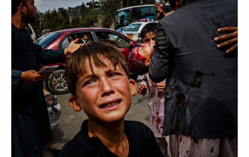 fot. Marcus Yam / LA Times, Chłopiec płacze, gdy mężczyzna niesie zakrwawione dziecko drogą prowadzącą na lotnisko w Kabulu. 17 września 2021 roku / Pulitzer Prize 2021 for Breaking News Photography