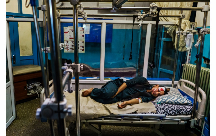 fot. Marcus Yam / LA Times, Ranny pacjent na oddziale ratunkowym szpitala Wazir Akbar Khan w Kabulu w Afganistanie, 26 sierpnia 2021 r. Po ataku zamachowca-samobójcy z grupy terrorystycznej ISIS-K, który uderzył w wejście Abbey Gate na lotnisku w Kabulu. Zginęło conajmniej 170 osób / Pulitzer Prize 2021 for Breaking News Photography