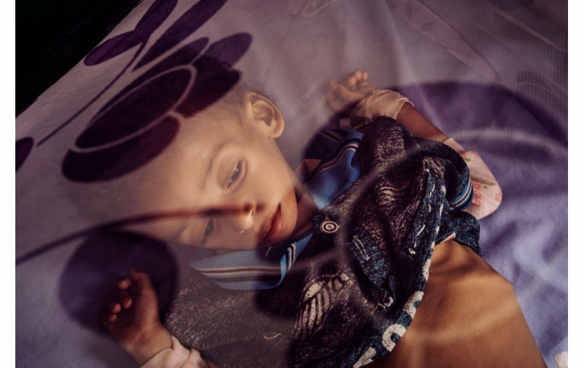 Nagroda Pulitzer 2019 w kategorii Feature Photography - Lorenzo Tugnoli (The Washington Post) | „Fotograficzna opowieść o tragicznym głodzie, który występuje w Jemenie. Losy mieszkańców zostały pokazane poprzez obrazy, w których piękno i opanowanie przeplatają się z dewastacją.“