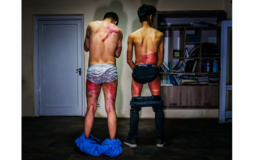 fot. Marcus Yam / LA Times, Dziennikarze rozbierają się, by pokazać rany zadane przez bojowników talibskich w Kabulu w Afganistanie 8 września 2021 r. Obaj byli torturowani w areszcie po aresztowaniu za dokumentację wiecu na rzecz praw kobiet. / Pulitzer Prize 2021 for Breaking News Photography