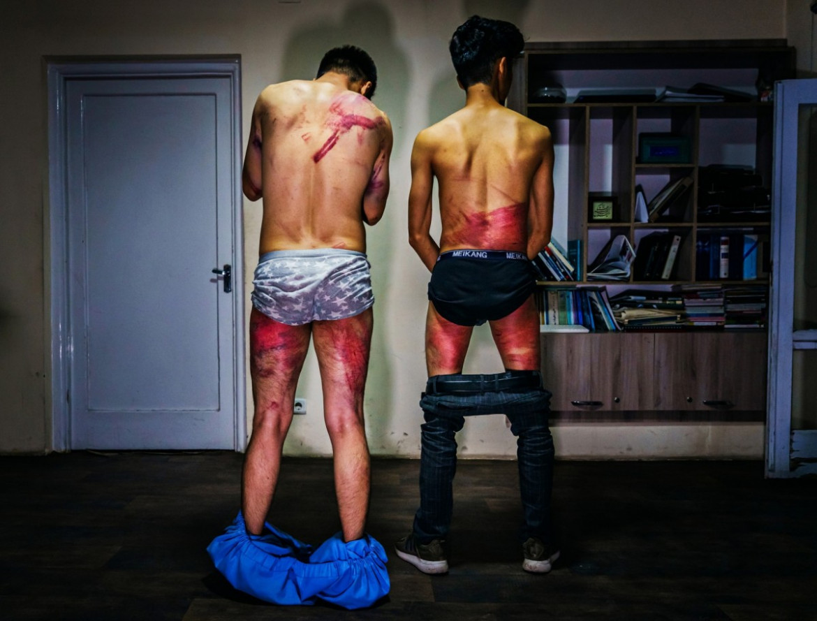 fot. Marcus Yam / LA Times, Dziennikarze rozbierają się, by pokazać rany zadane przez bojowników talibskich w Kabulu w Afganistanie 8 września 2021 r. Obaj byli torturowani w areszcie po aresztowaniu za dokumentację wiecu na rzecz praw kobiet. / Pulitzer Prize 2021 for Breaking News Photography
