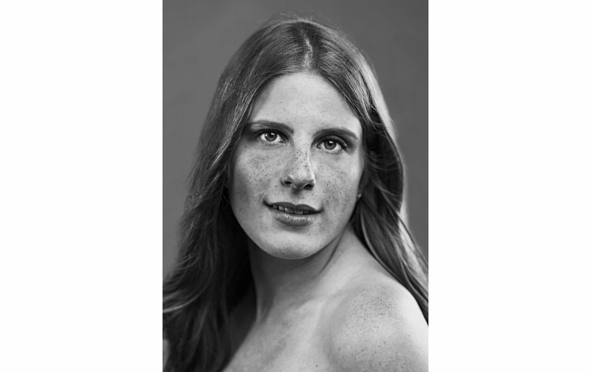 fot. Gabrielle Robinson, z cyklu Freckles, 2. miejsce w kategorii Portrait / Series