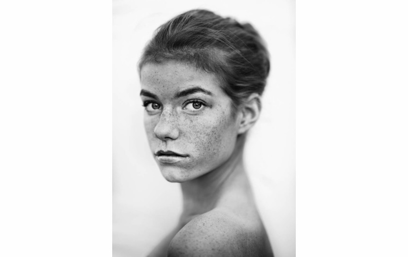 fot. Gabrielle Robinson, z cyklu Freckles, 2. miejsce w kategorii Portrait / Series