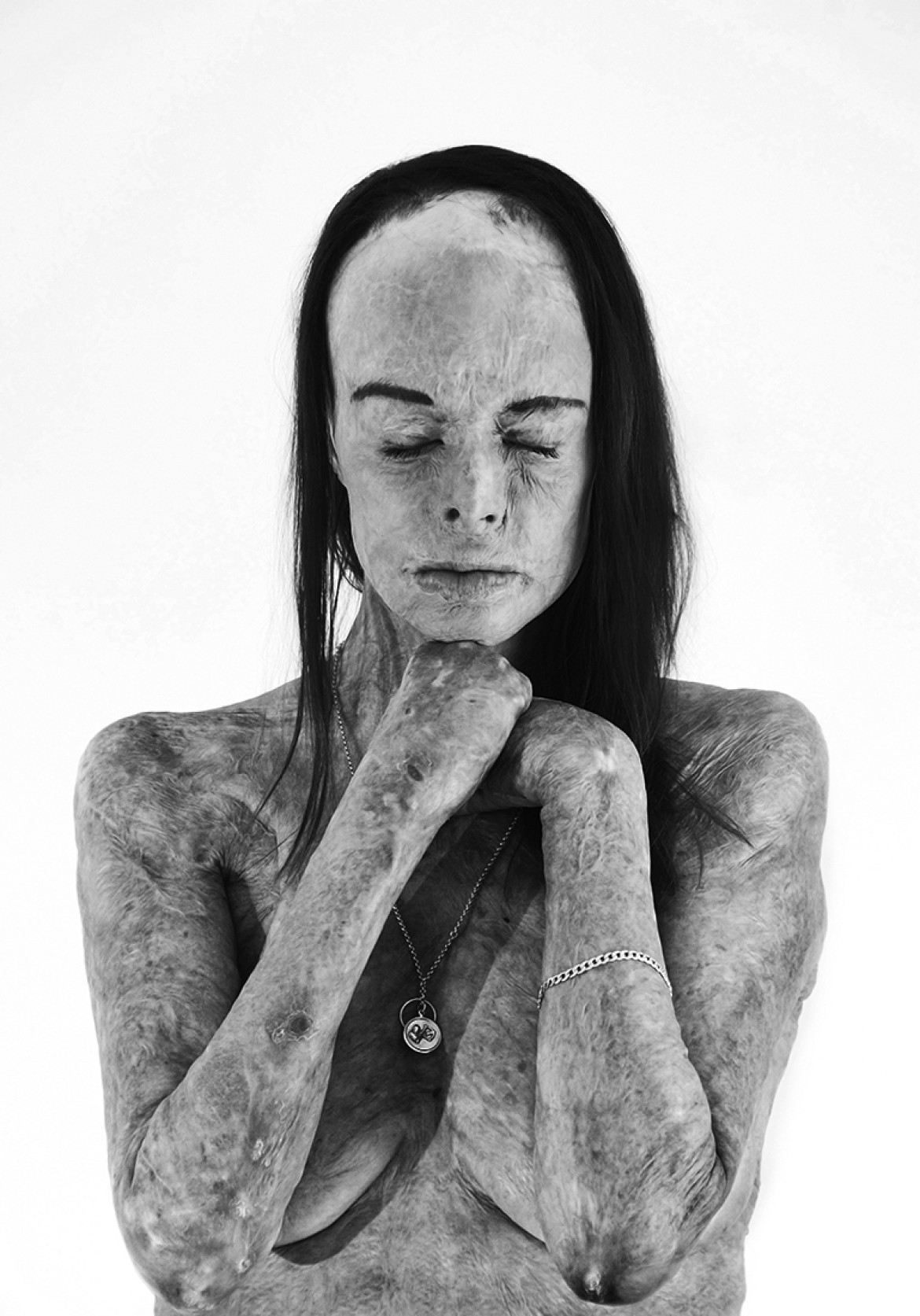 fot. Brian Cassey, "The Skin I'm In - II", 2. miejsce w kategorii Portrait