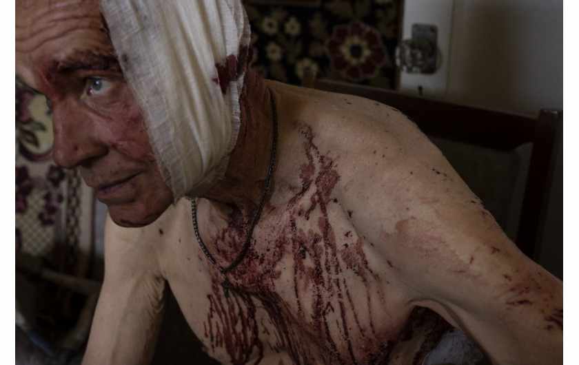 fot. Nariman El-Mofty,  66-letni ranny Wołodymyr, siedzi na krześle w swoim zniszczonym mieszkaniu w Kramatorsku, obwód doniecki, wschodnia Ukraina, 7 lipca 2022 r. 