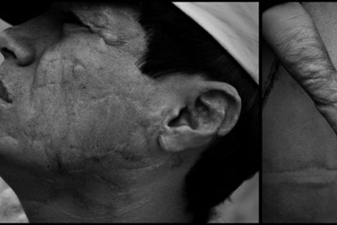 Wystawa "Dzieci Ulicy" Krystiana Bielatowicza w Warszawie