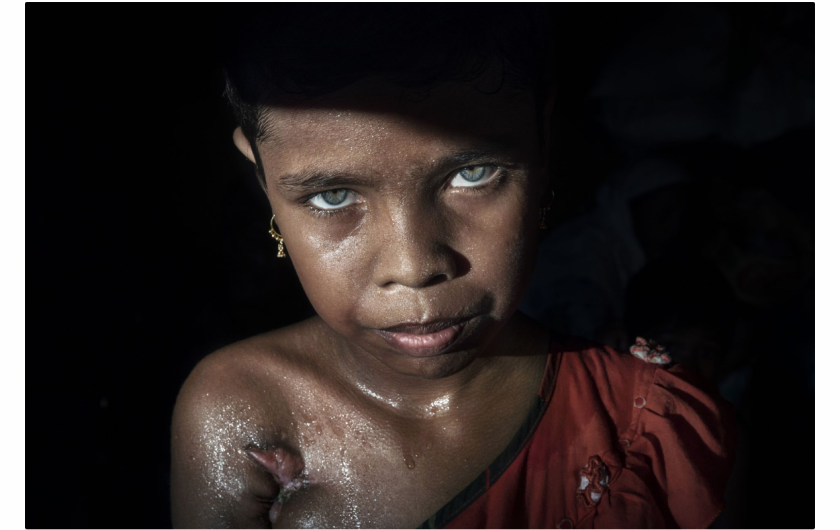 Paula Bronstein „The unwanted, the Rohingya“, III miejsce w kategorii Storyboard Siena International Photo Awards 2018 | Bezpaństwowcowi, splątani i niechciani: przez większość buddyjskiej Mjanmy zmagał się z głęboko zakorzenioną nienawiścią do społeczności Rohingya (w zachodnim stanie Rakhine). Ta muzułmańska mniejszość etniczna była zawsze uważana za „nielegalnego imigranta z Bangladeszu“ i pozbawiona praw obywatelskich. Rząd Mjanmy nałożył surowe ograniczenia na swobodę przemieszczania się, edukację państwową, służbę cywilną i opiekę zdrowotną. Rohingya utrzymuje, że są oni rdzennymi mieszkańcami Zachodu. W efekcie atak na siły bezpieczeństwa państwowego przez powstańców Rohingya doprowadził do brutalnej represji wojskowej, która zmusiła ponad połowę kraju (ponad miliona ludzi) do ucieczki do sąsiedniego Bangladeszu, tworząc najszybszy transgraniczny exodus. Wielu uchodźców opowiadało o prawdziwym horrorze: gwałtach, zabójstwach, spaleniach setek wiosek. Poza tym tysiące dzieci, które podróżują same, są poważnie zagrożone handlem i wyzyskiem.