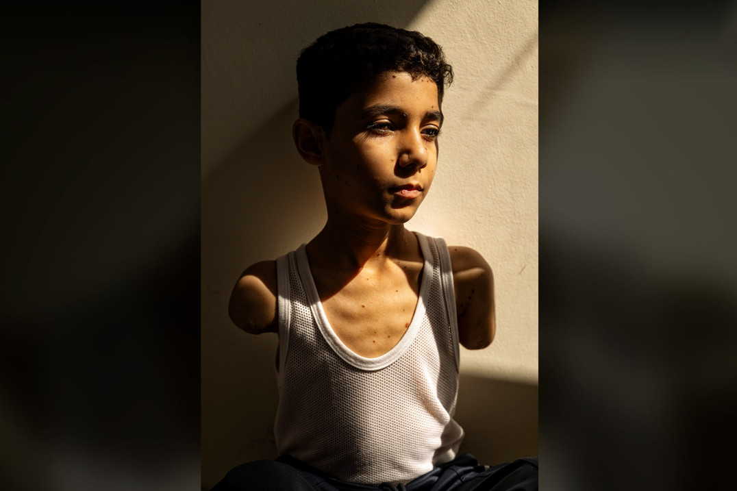 Przejmujący portret chłopca ze Strefy Gazy Zdjęciem Roku World Press Photo 2025