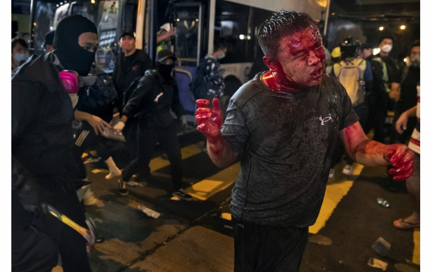 fot, Thomas Peter. Zamaskowany uczestnik zamieszek atakuje młotkiem mężczyznę, którego gapie wskazali jako prorządowego aktywistę z Chin. Hong Kong, Chiny, 11 listopada 2019 / Pulitzer Prize for Breaking News Photography 2020