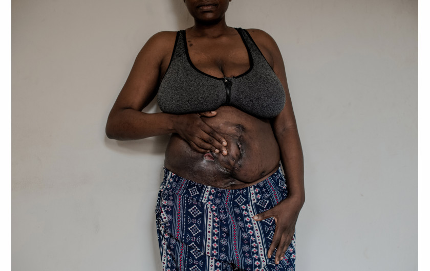 Fot. Kasia Strek, dla The Guardian, 1. miejsce w kat. Stories - People / Grand Press Photo 2024 Nigeria ma jeden z najwyższych współczynników dzietności na świecie, a liczba ludności ma wzrosnąć z 200 milionów do 400 milionów do 2050 roku. Jest to również jeden z krajów o najwyższym wskaźniku umieralności okołoporodowej matek. Większości zgonów można zapobiec i są one związane z brakiem placówek opieki zdrowotnej, wystarczającej edukacji i wyszkolonego personelu, zwłaszcza w odległych obszarach. Możliwość przedwczesnej śmierci wydaje się integralną częścią bycia kobietą w tym kraju.