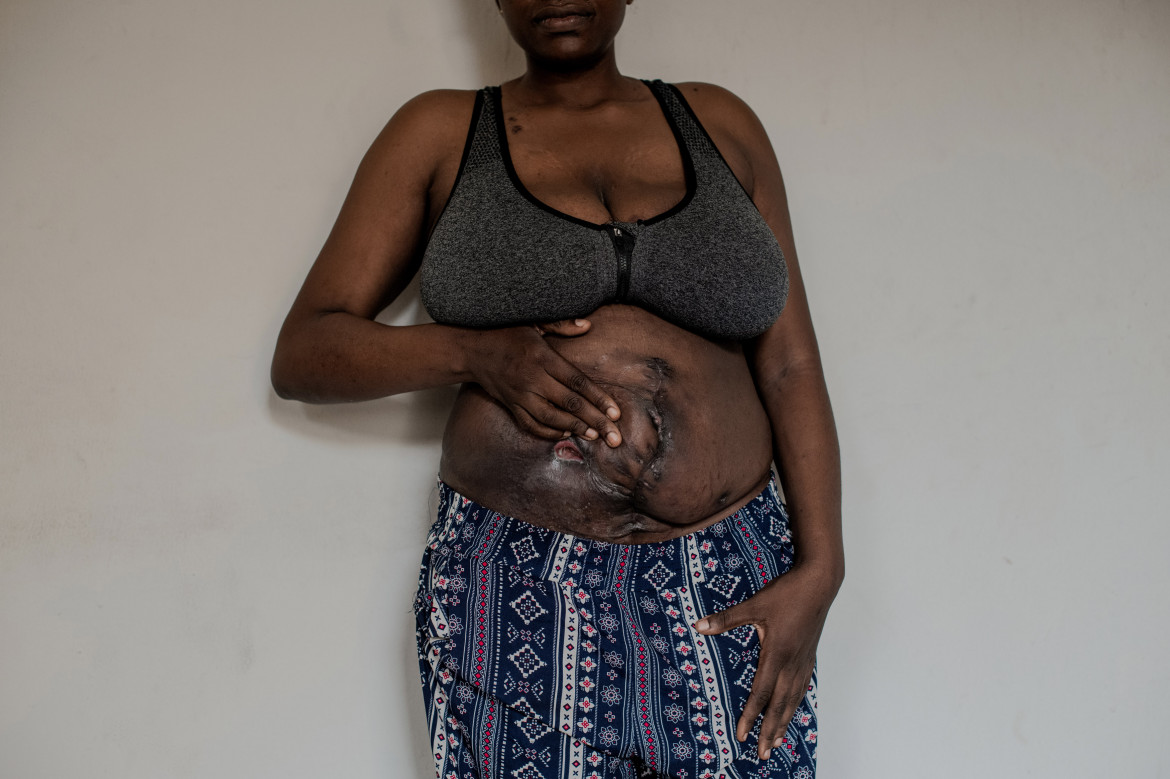 Fot. Kasia Strek, dla "The Guardian", 1. miejsce w kat. Stories - People / Grand Press Photo 2024<br></br><br></br> Nigeria ma jeden z najwyższych współczynników dzietności na świecie, a liczba ludności ma wzrosnąć z 200 milionów do 400 milionów do 2050 roku. Jest to również jeden z krajów o najwyższym wskaźniku umieralności okołoporodowej matek. Większości zgonów można zapobiec i są one związane z brakiem placówek opieki zdrowotnej, wystarczającej edukacji i wyszkolonego personelu, zwłaszcza w odległych obszarach. Możliwość przedwczesnej śmierci wydaje się integralną częścią bycia kobietą w tym kraju.
