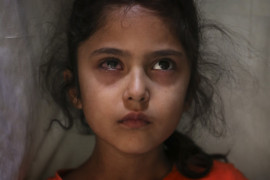 fot. Mukhtar Khan. 6-letnia Muneefa Nazir, która rzekomo została postrzelona marmurową kulą przez indyjski oddział paramilitarny 12 sierpnia. 17 września 2019 / The Pulitzer Prize 2020 for Feature Photography