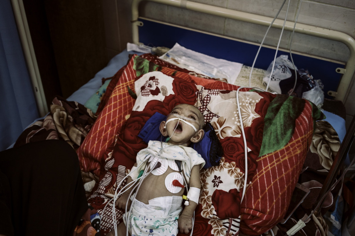 fot. Lorenzo Tugnoli, Contrasto (dla Washington Post), z cyklu "the Yemen Crisis", Nominacja do nagrody World Press Photo Story of the Year

Po niemal 4 latach konfliktu w Jemenie, przynajmniej 8,4 mln osób zagrożonych jest głodem, a 22 miliony (75% populacji) wymaga pomocy humanitarnej.  
W 2014 roku muzułmańscy rebelianci Houthi Shia oblężyły północ kraju, zmuszając prezydenta Abdrabbuha Mansoura Hadiego do ustąpienia ze stanowiska. Konflikt rozprzestrzenił się gdy Arabia Saudyjska w koalicji z innymi państwami sunnickimi rozpoczęła naloty na pozycje Houthi. Do 2018 roku doprowadziło to jednej największych katastrof humanitarnych naszych czasów. 