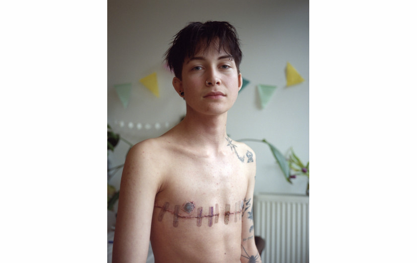 Fot. Prins de Vos, Queer Gallery, Mika, nagroda w kat. regionalnej Europe / World Press Photo 2025Mika (21) od 22 miesięcy czeka na pierwszą konsultację w klinice gender. W międzyczasie osobiście pokrył koszty operacji i leczenia hormonalnego. W końcu odbył pierwszą konsultację w maju 2024 roku. Rotterdam, Holandia, 2 lutego 2024 r.

Wydłużone oczekiwanie na pierwszą wizytę w celu oficjalnego potwierdzenia płci jest codziennością zarówno w Holandii, jak i na całym świecie. Wpływ tej sytuacji na samopoczucie osób niebinarnych i transpłciowych może być bardzo głęboki, powodując frustrację, izolację i rozpacz. Fotograf ma na celu podkreślenie tych kwestii, wspieranie większego zrozumienia wpływu oczekiwania na życie ludzi oraz zachęcanie do bardziej inkluzywnego i współczującego podejścia do opieki potwierdzającej płeć.