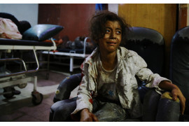 2. miejsce w kategorii "General News - cykle", fot. Abd Dounmany, z cyklu "Douma's Children"