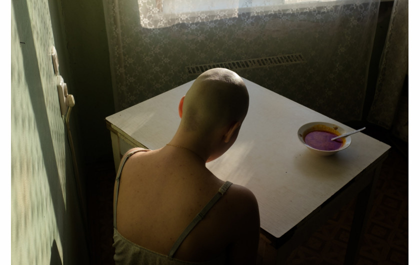 fot. Alyona Kochetkova, When I Was Ill, 3. miejsce w kategorii Portraits.

Autoportret wykonany przez Kochetkovą w czasie trwania chemioterapii, gdy nie mogła zmusić się do jedzenia. Zdjęcia miały nie tylko wesprzeć innych chorych na raka, ale także pomóc jej w uporaniu się z własną męką poprzez robienie tego, co kocha.