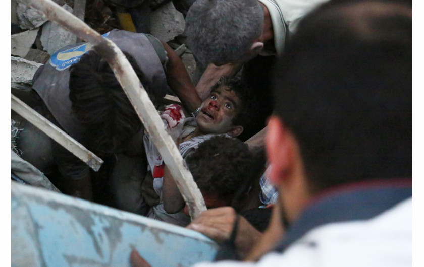 1. miejsce w kategorii Spot News - cykle, fot. Sameer Al-Doumy, z cyklu Skutki bombardowań w Syrii