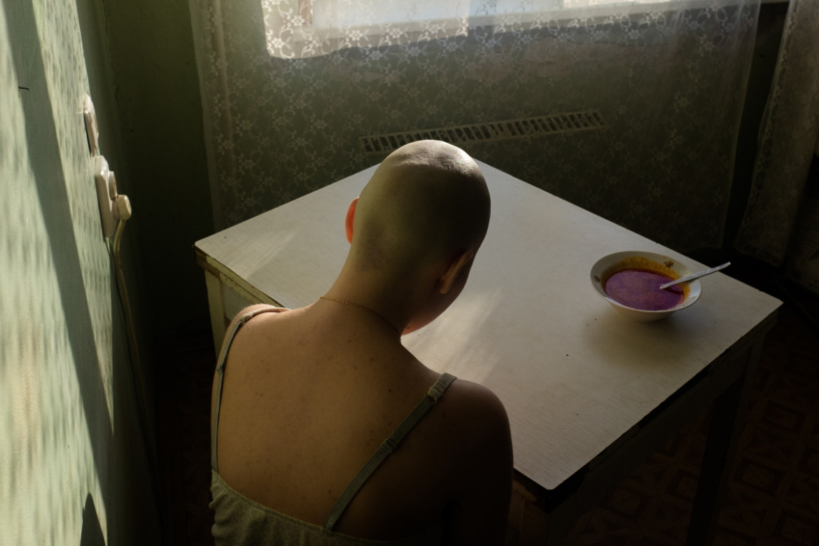 fot. Alyona Kochetkova, "When I Was Ill", 3. miejsce w kategorii Portraits.
Autoportret wykonany przez Kochetkovą w czasie trwania chemioterapii, gdy nie mogła zmusić się do jedzenia. Zdjęcia miały nie tylko wesprzeć innych chorych na raka, ale także pomóc jej w uporaniu się z własną męką poprzez robienie tego, co kocha.