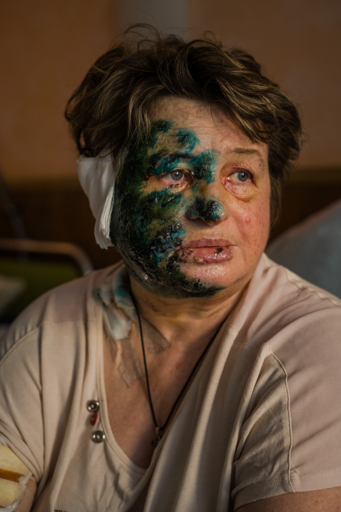 Halina Morochowska (59 l.) z Mariupola została ranna podczas ostrzału hostelu, w którym pracowała. Przeżyła, ale dwóch jej kolegów zginęło. Została zabrana przez rodzinę ze szpitala w Mariupolu i przywieziona, po ryzykownej podróży do jednego ze szpitali w Zaporożu.
22 marca 2022 r., Zaporoże, Ukraina
fot. Wojciech Grzędziński