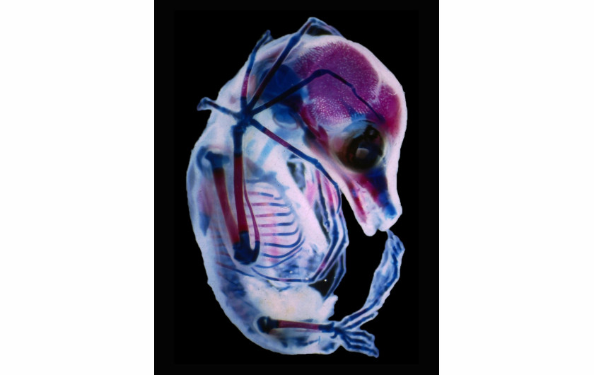 fot. Dr. Rick Adams, 3-tygodniony płód nietoperza z rodziny Megachiroptera, 15. miejsce w konkursie