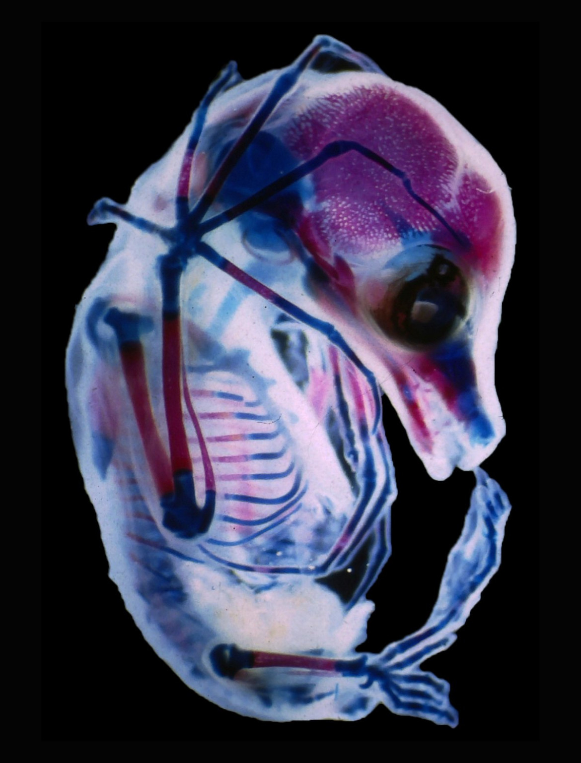 fot. Dr. Rick Adams, 3-tygodniony płód nietoperza z rodziny Megachiroptera, 15. miejsce w konkursie